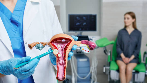 Best Fibroid Treatment Surgeon in Borivali
