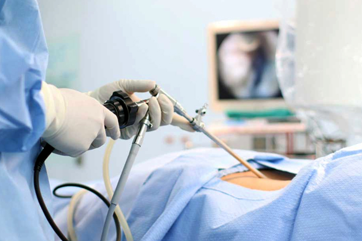 Best Fibroids Specialist in Borivali