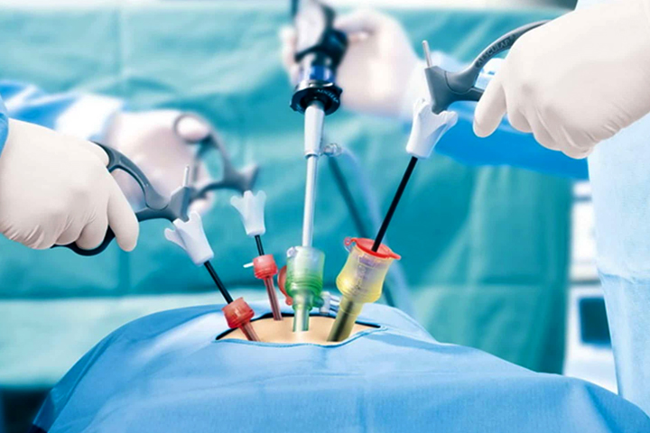 Best Gynec Laparoscopic Surgeon in Mumbai